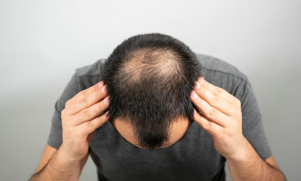 9 Ways to Stop hair loss and grow hairs back successfully!